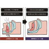 【昼におはよう】鼻呼吸誘導サポーター GoodSleeper S-M